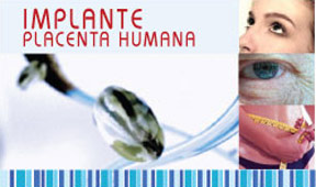 Implant human Placent Implant human Placent