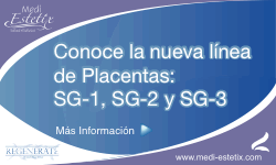 SG1-SG2-SG3 SG1-SG2-SG3